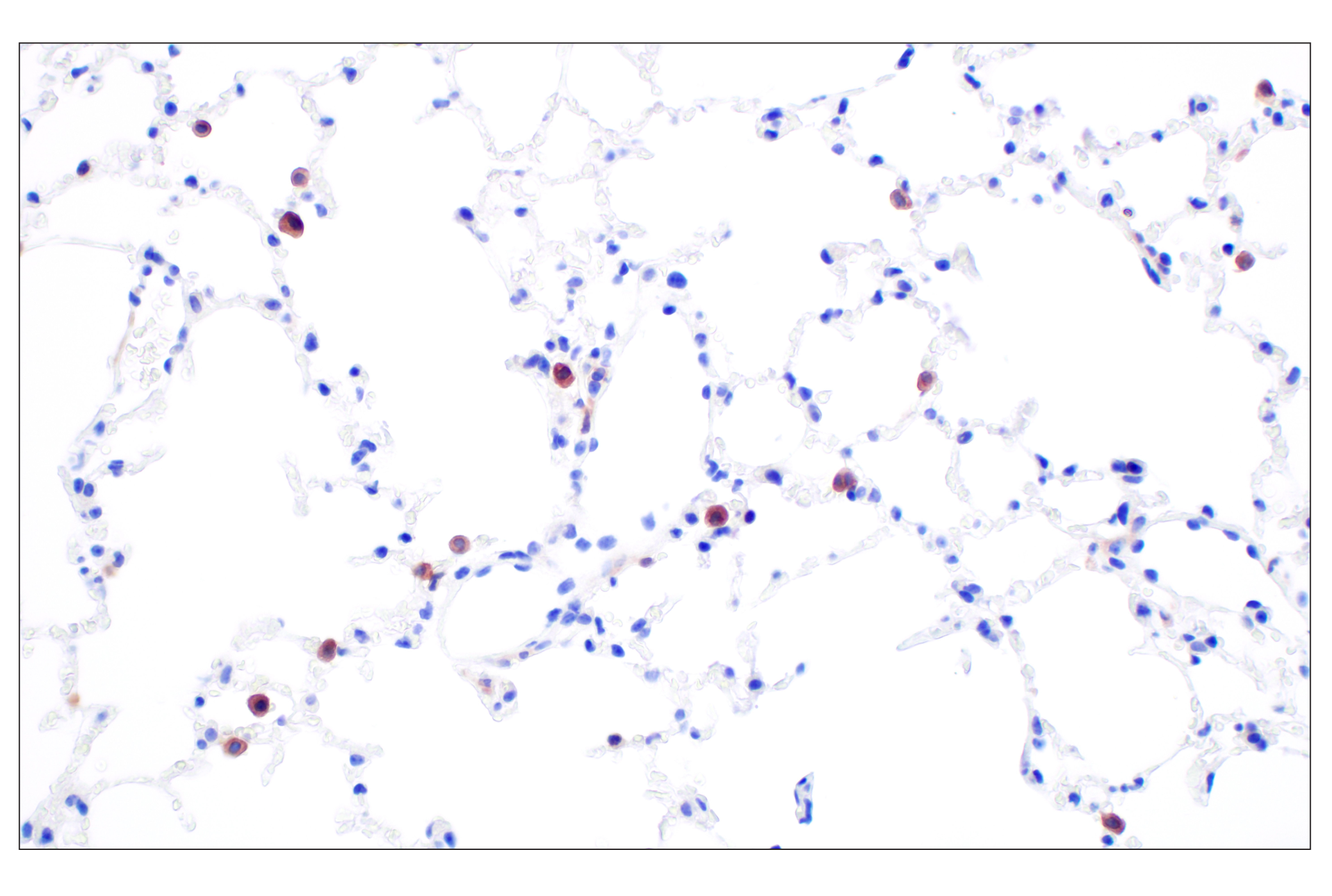 Immunohistochemistry Image 5: Dectin-1/ Clec7a (E3P5W) Rabbit mAb (BSA and Azide Free)