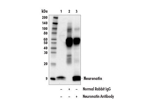 Immunoprecipitation Image 1: Neuronatin Antibody