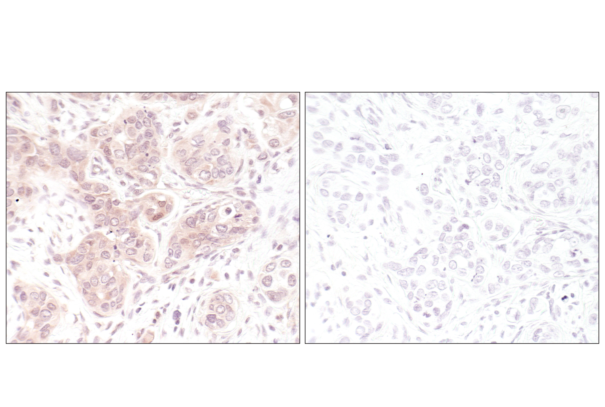 Immunohistochemistry Image 1: p44/42 MAPK (Erk1/2) (L34F12) Mouse mAb (BSA and Azide Free)