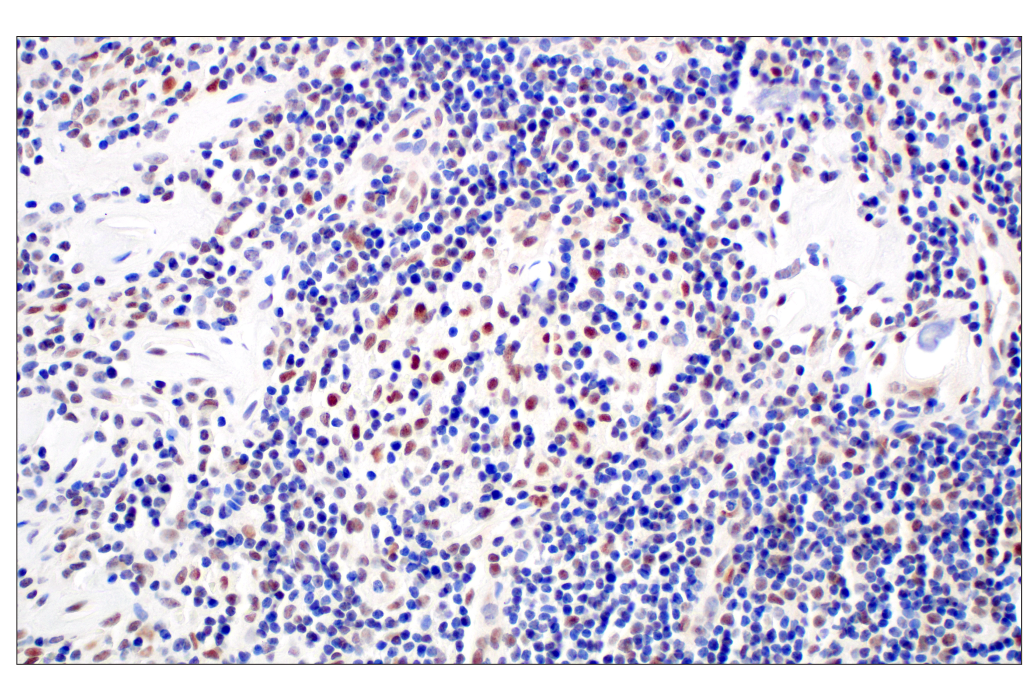Immunohistochemistry Image 5: TCF12/HEB (E5R8X) Rabbit mAb