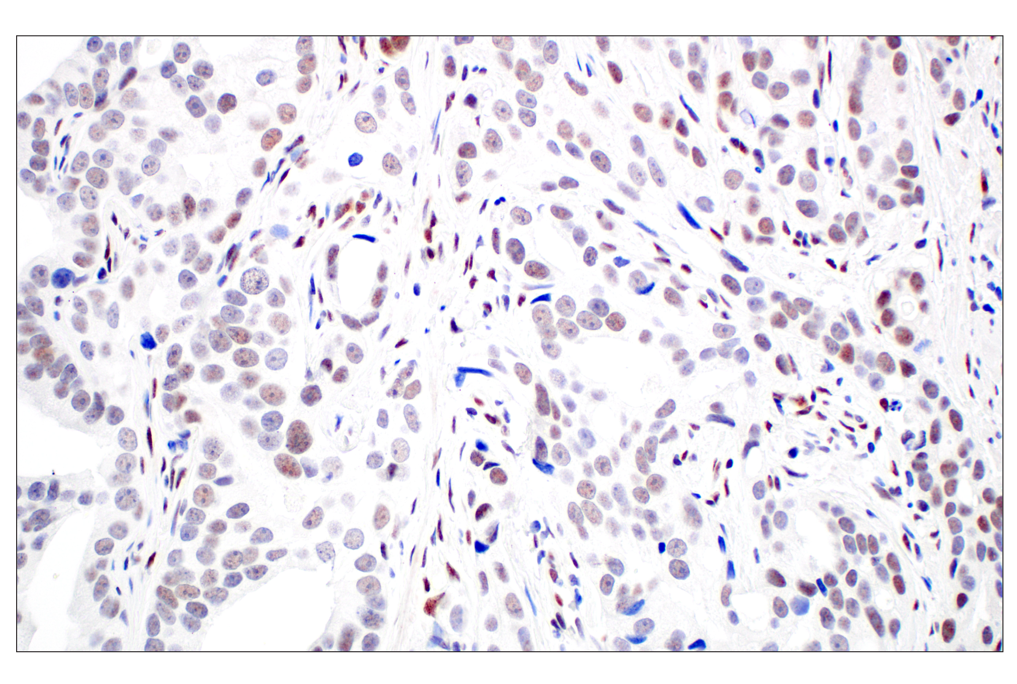 Immunohistochemistry Image 4: TCF12/HEB (E5R8X) Rabbit mAb