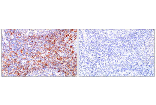 Immunohistochemistry Image 13: Siglec-10 (E1D7S) XP® Rabbit mAb (BSA and Azide Free)
