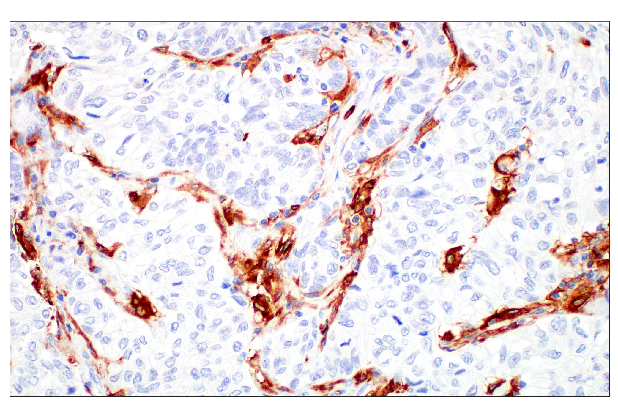 Immunohistochemistry Image 1: Siglec-10 (E1D7S) XP® Rabbit mAb (BSA and Azide Free)