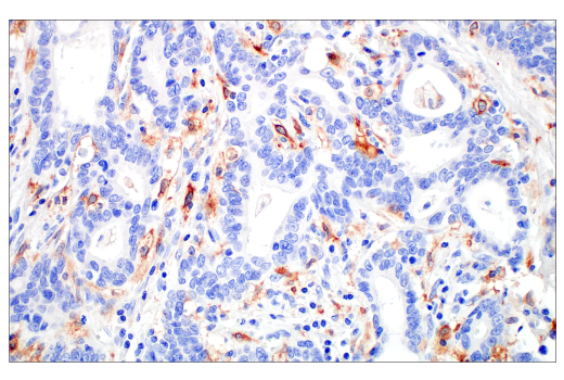 Immunohistochemistry Image 2: Siglec-10 (E1D7S) XP® Rabbit mAb (BSA and Azide Free)