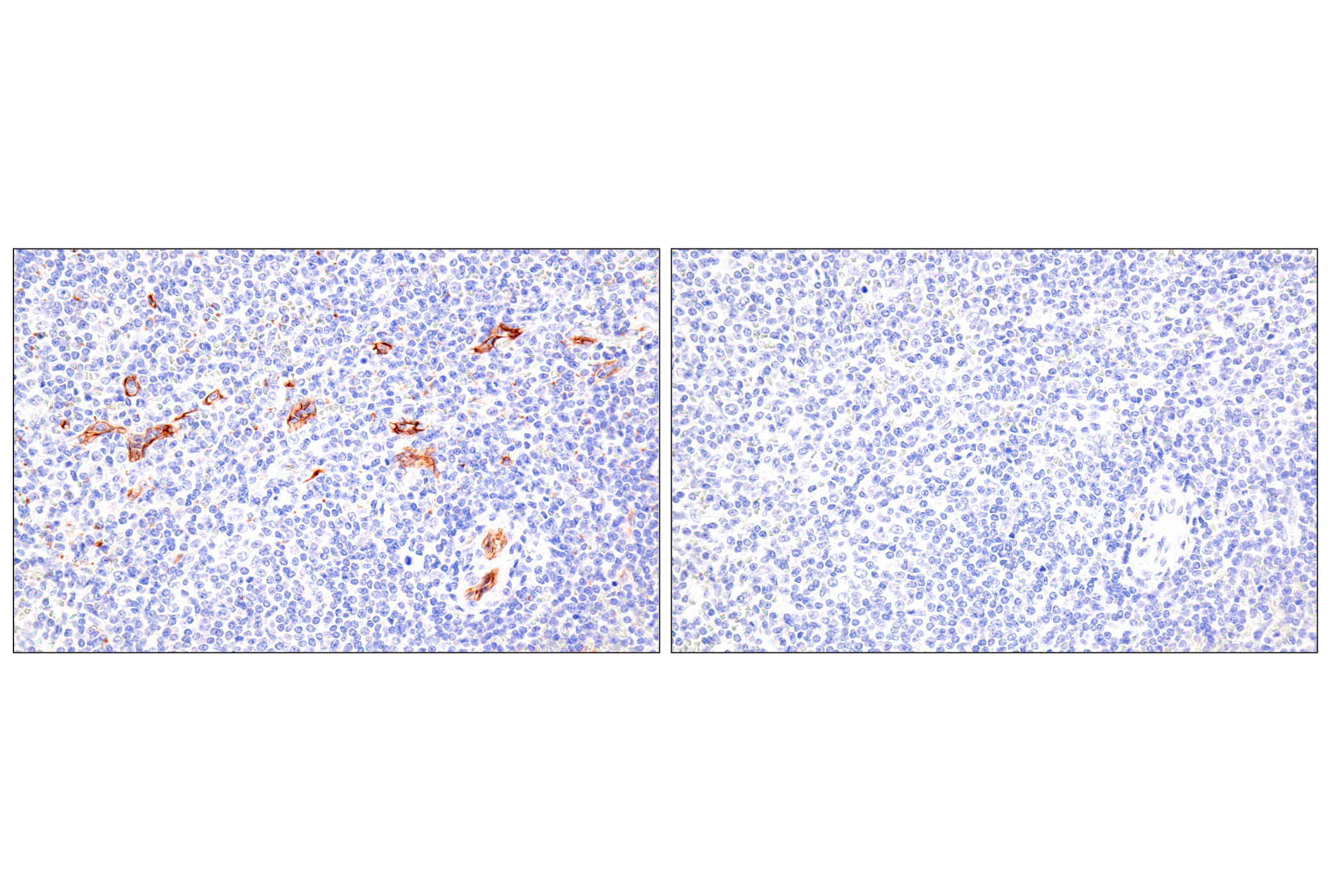 Immunohistochemistry Image 8: Claudin-5 (E5D9Y) Rabbit mAb (BSA and Azide Free)