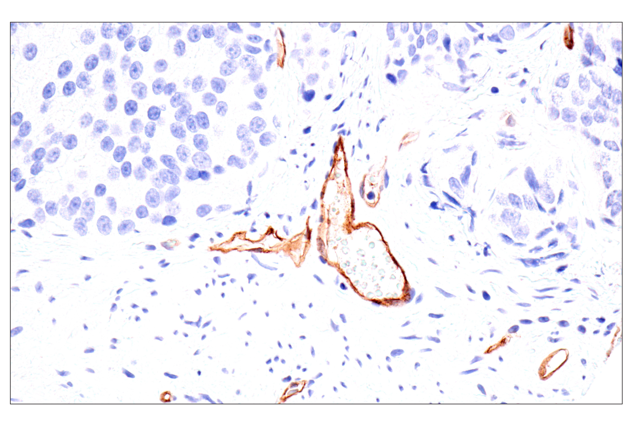 Immunohistochemistry Image 4: Claudin-5 (E5D9Y) Rabbit mAb (BSA and Azide Free)