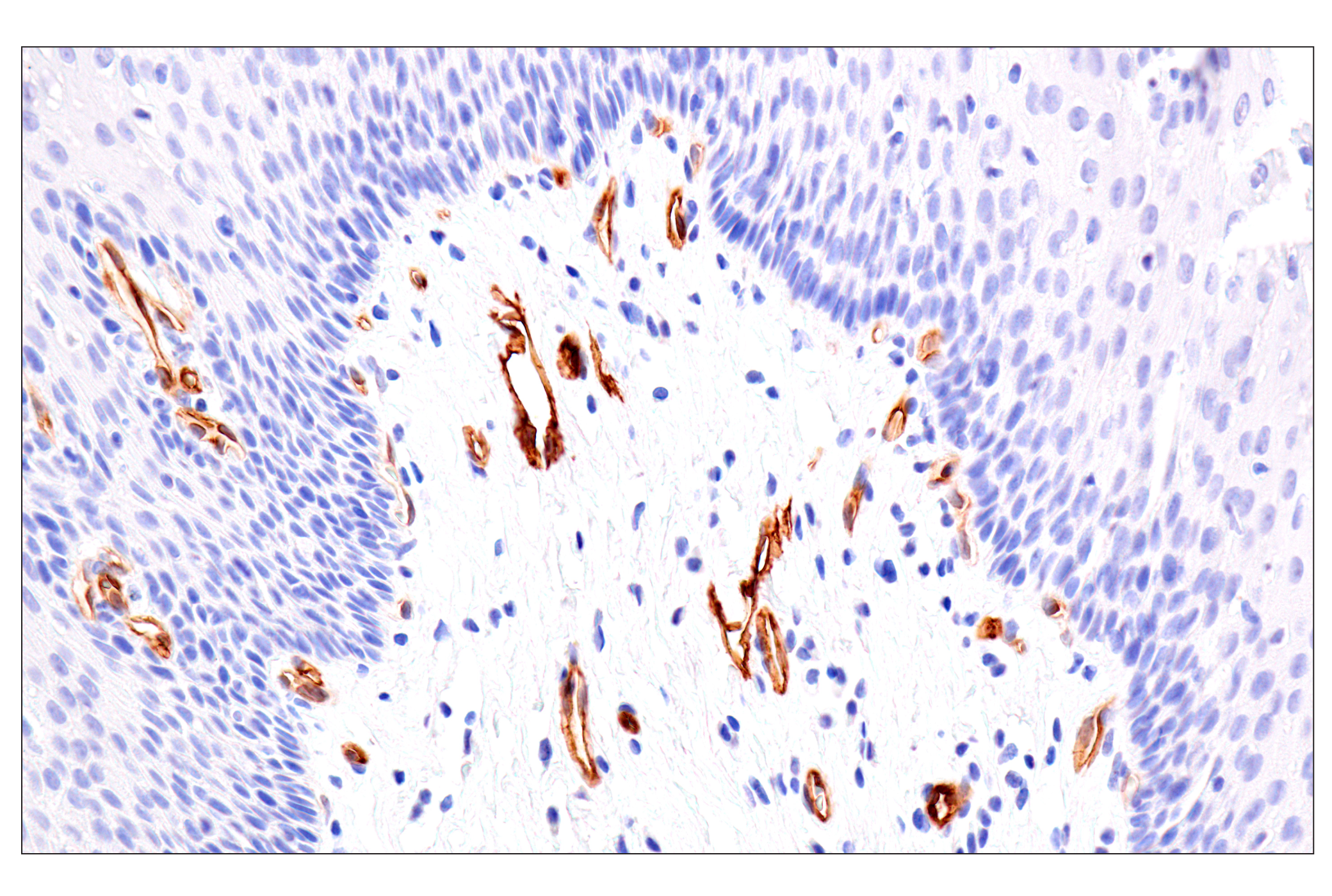 Immunohistochemistry Image 7: Claudin-5 (E5D9Y) Rabbit mAb (BSA and Azide Free)