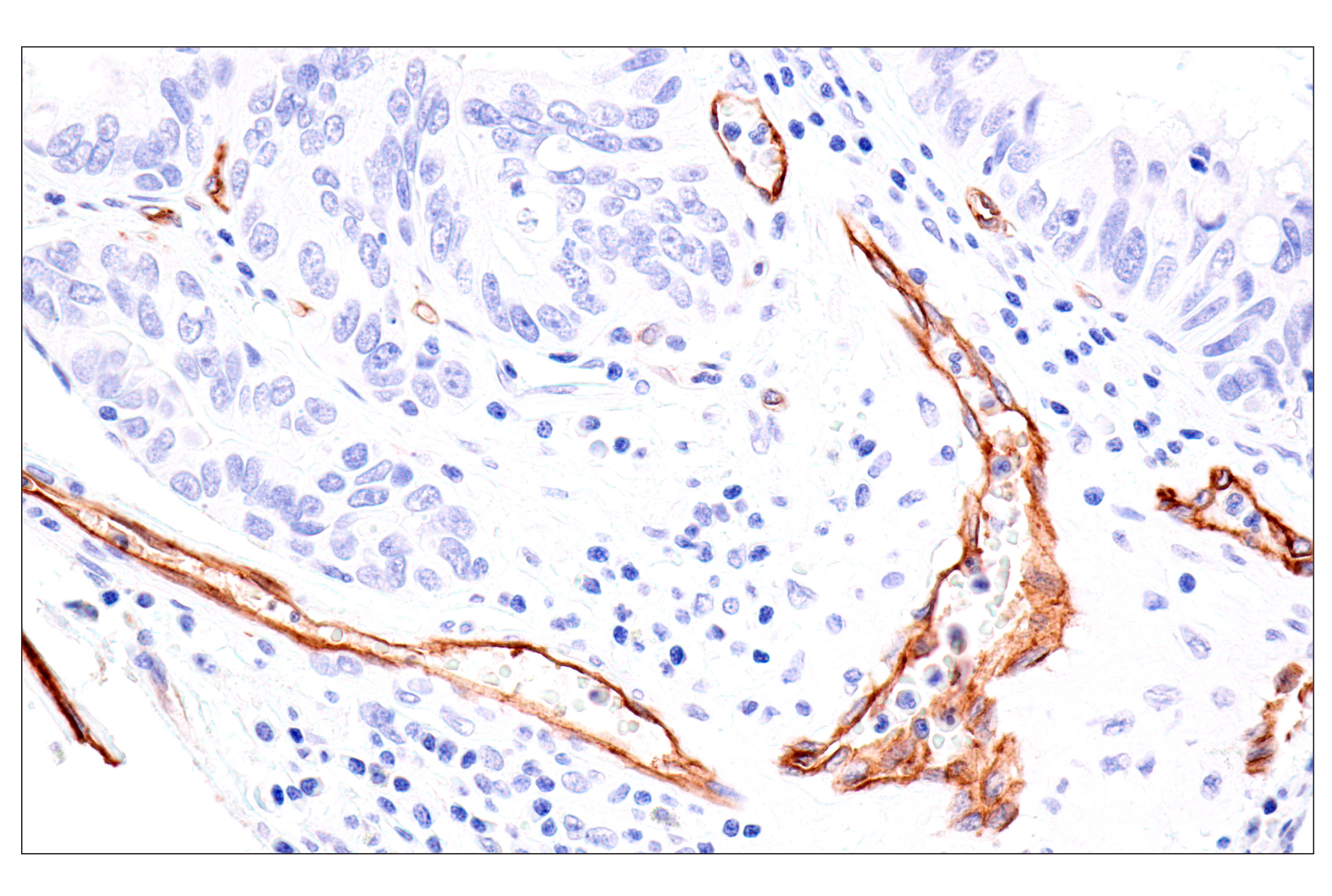 Immunohistochemistry Image 3: Claudin-5 (E5D9Y) Rabbit mAb (BSA and Azide Free)