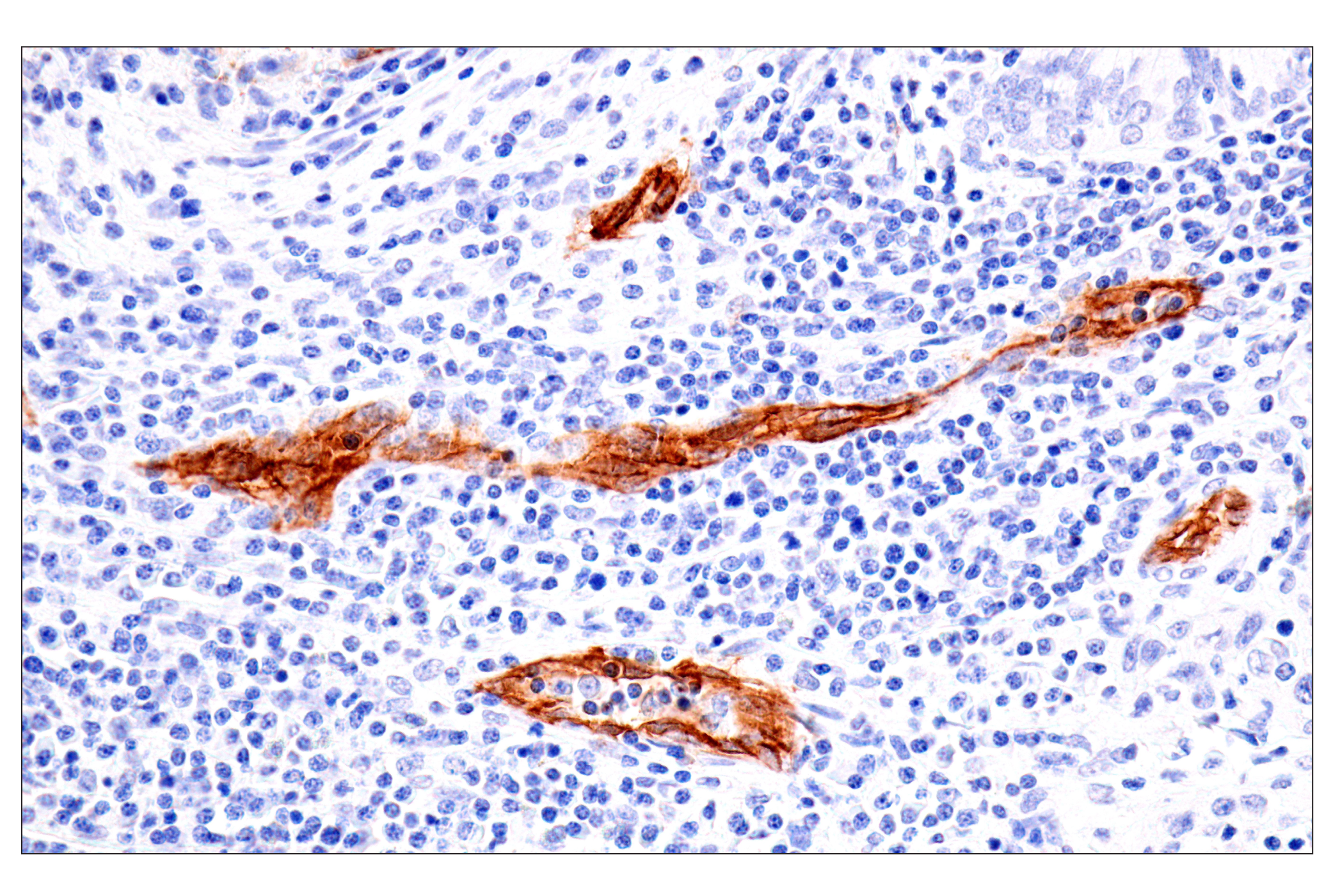 Immunohistochemistry Image 1: Claudin-5 (E5D9Y) Rabbit mAb (BSA and Azide Free)
