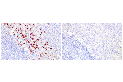 Immunohistochemistry Image 6: MMP-8 (E1C4L) Rabbit mAb