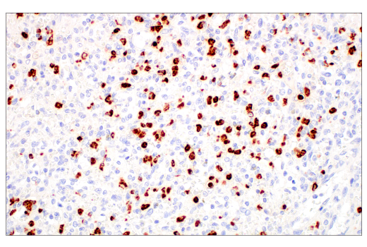 Immunohistochemistry Image 1: MMP-8 (E1C4L) Rabbit mAb