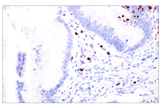 Immunohistochemistry Image 4: MMP-8 (E1C4L) Rabbit mAb