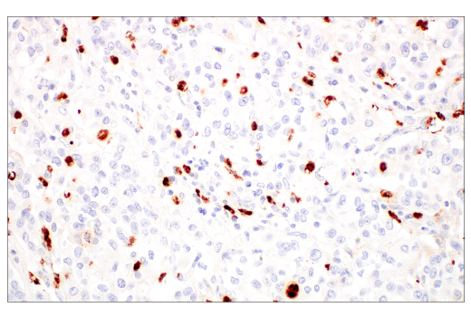 Immunohistochemistry Image 2: MMP-8 (E1C4L) Rabbit mAb