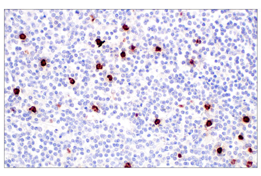 Immunohistochemistry Image 5: MMP-8 (E1C4L) Rabbit mAb