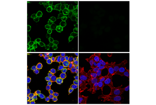 Immunofluorescence Image 3: FcRγ (E6Y1A) Rabbit mAb