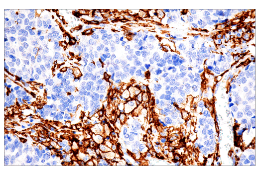 Immunohistochemistry Image 1: FcRγ (E6Y1A) Rabbit mAb