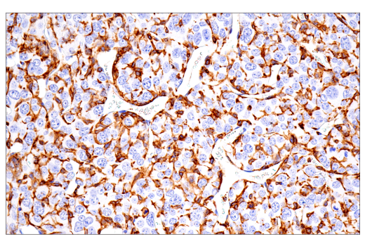 Immunohistochemistry Image 14: FcRγ (E6Y1A) Rabbit mAb