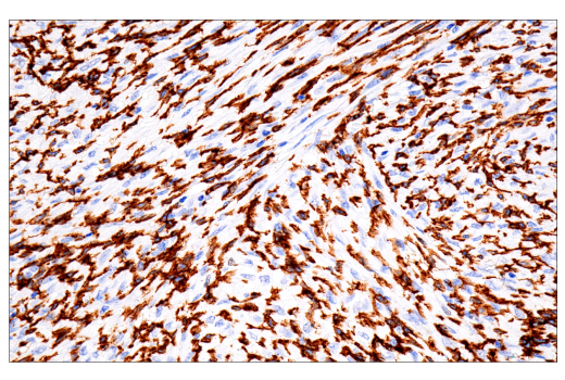 Immunohistochemistry Image 2: FcRγ (E6Y1A) Rabbit mAb