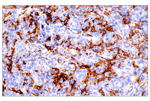 Immunohistochemistry Image 3: FcRγ (E6Y1A) Rabbit mAb