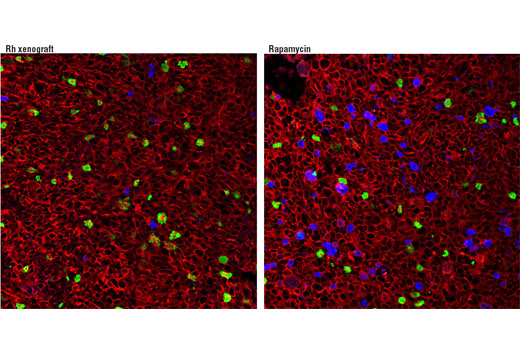 Immunofluorescence Image 1: PathScan® Apoptosis and Proliferation Multiplex IF Kit