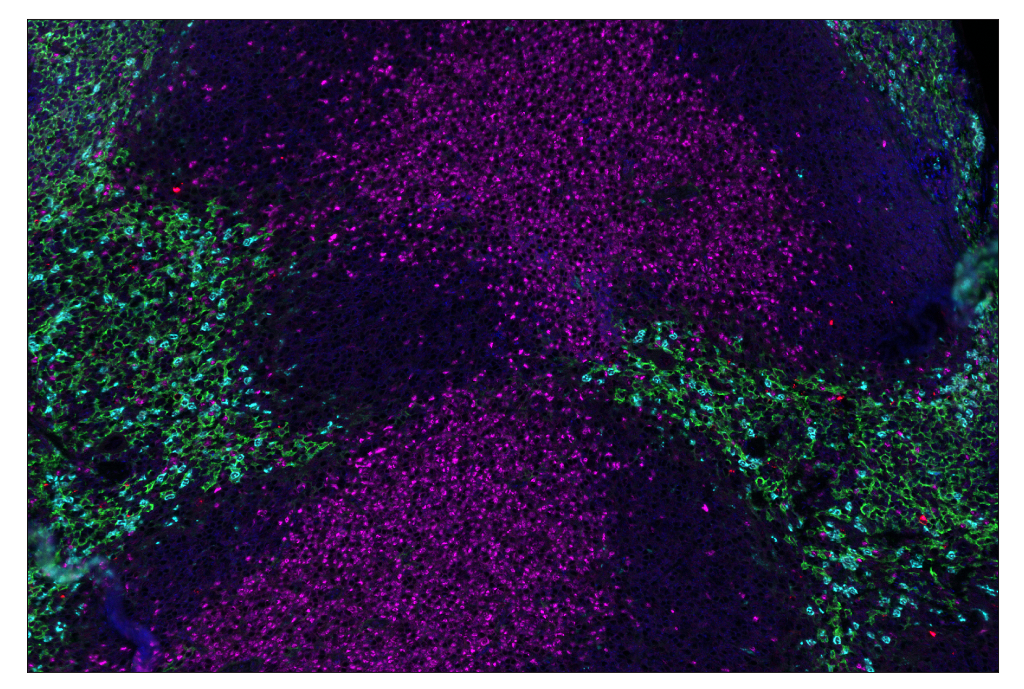 Immunohistochemistry Image 8: F4/80 (D2S9R) & CO-0042-594 SignalStar™ Oligo-Antibody Pair