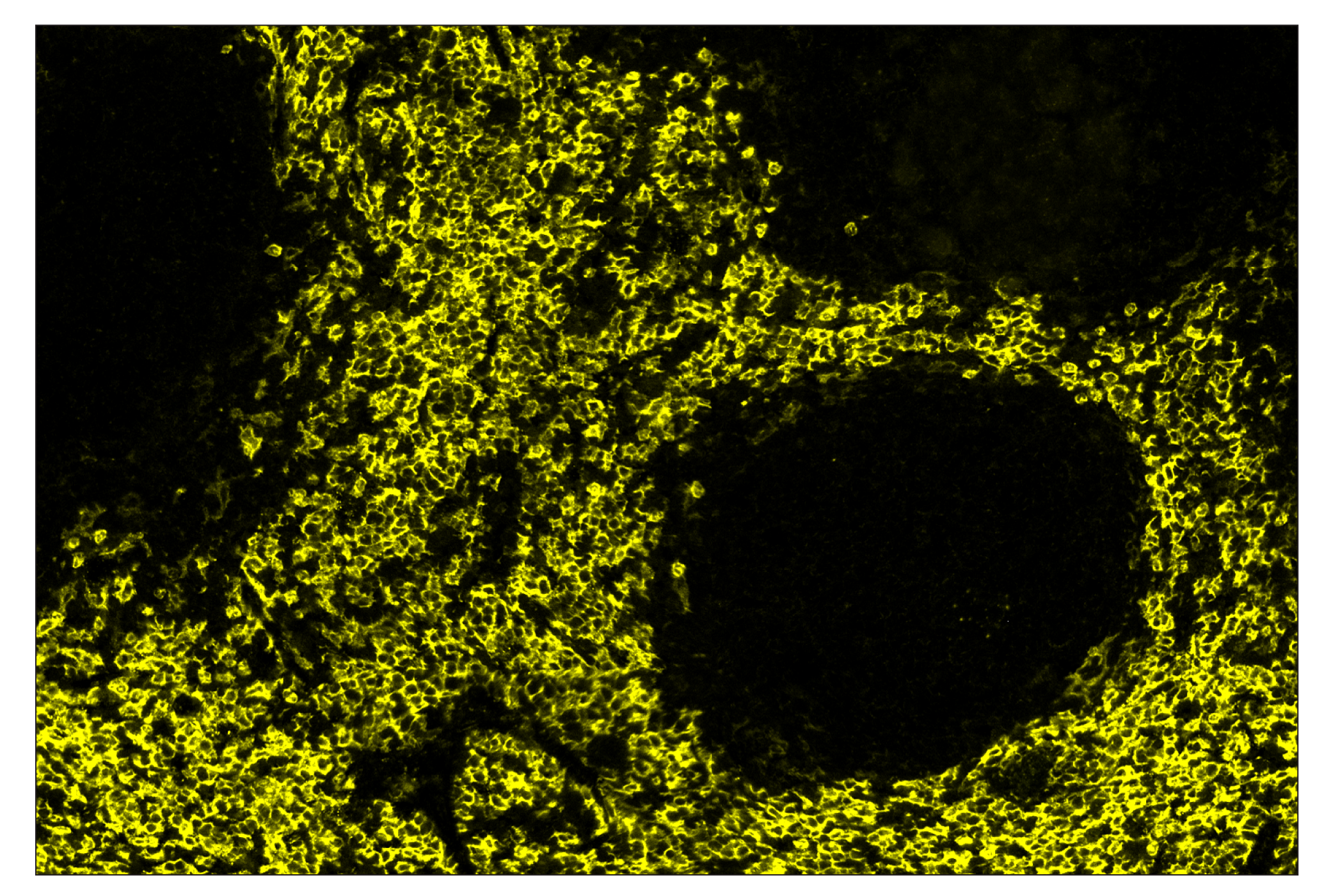 Immunohistochemistry Image 3: F4/80 (D2S9R) & CO-0042-594 SignalStar™ Oligo-Antibody Pair