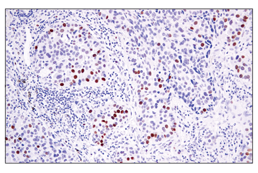 Immunohistochemistry Image 3: ATAD2 (E8Y2K) Rabbit mAb