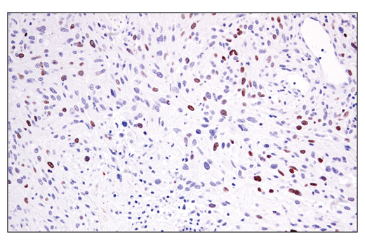 Immunohistochemistry Image 6: ATAD2 (E8Y2K) Rabbit mAb