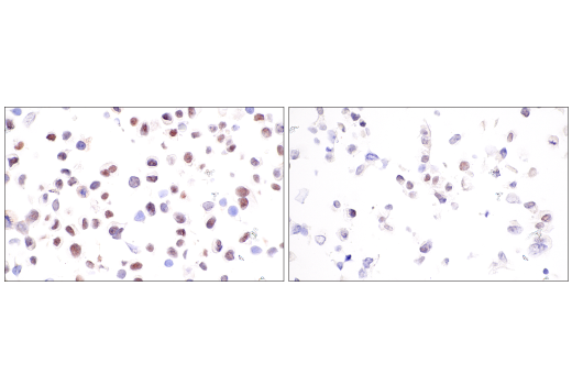 Immunohistochemistry Image 8: PMS2 (M0R4G) Mouse mAb