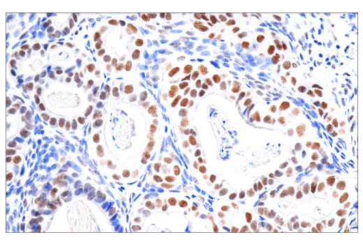 Immunohistochemistry Image 2: PMS2 (M0R4G) Mouse mAb