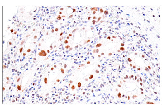 Immunohistochemistry Image 4: PMS2 (M0R4G) Mouse mAb