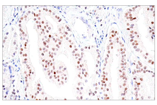 Immunohistochemistry Image 3: PMS2 (M0R4G) Mouse mAb