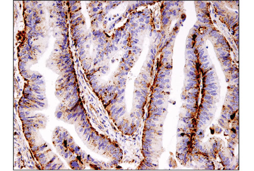 Immunohistochemistry Image 1: Cathepsin B (D1C7Y) XP® Rabbit mAb (BSA and Azide Free)
