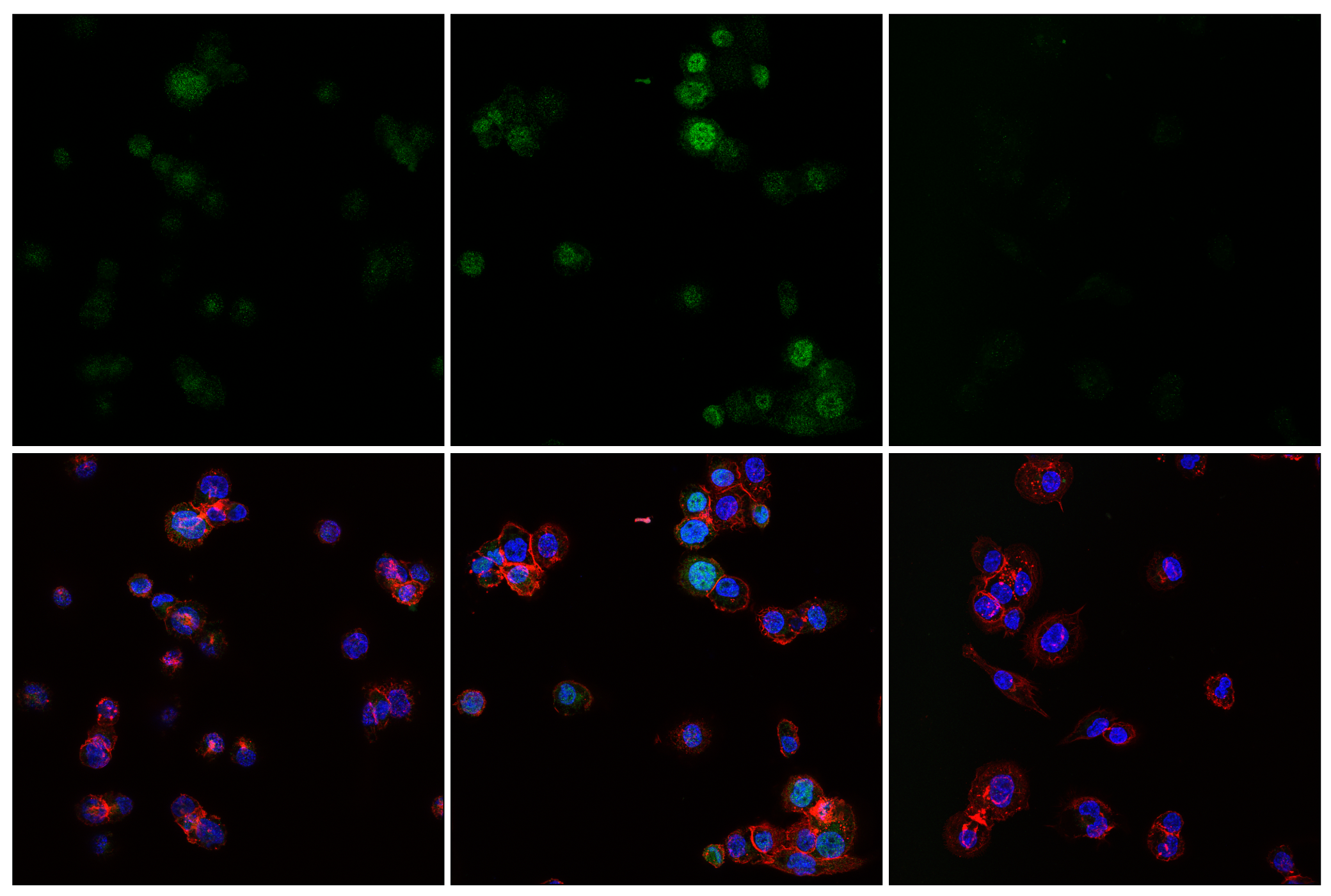 Immunofluorescence Image 1: Phospho-NF-κB p65 (Ser529) (E3K3J) Rabbit mAb