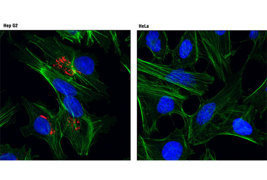 Immunofluorescence Image 1: AFP (3H8) Mouse mAb (Alexa Fluor® 594 Conjugate)