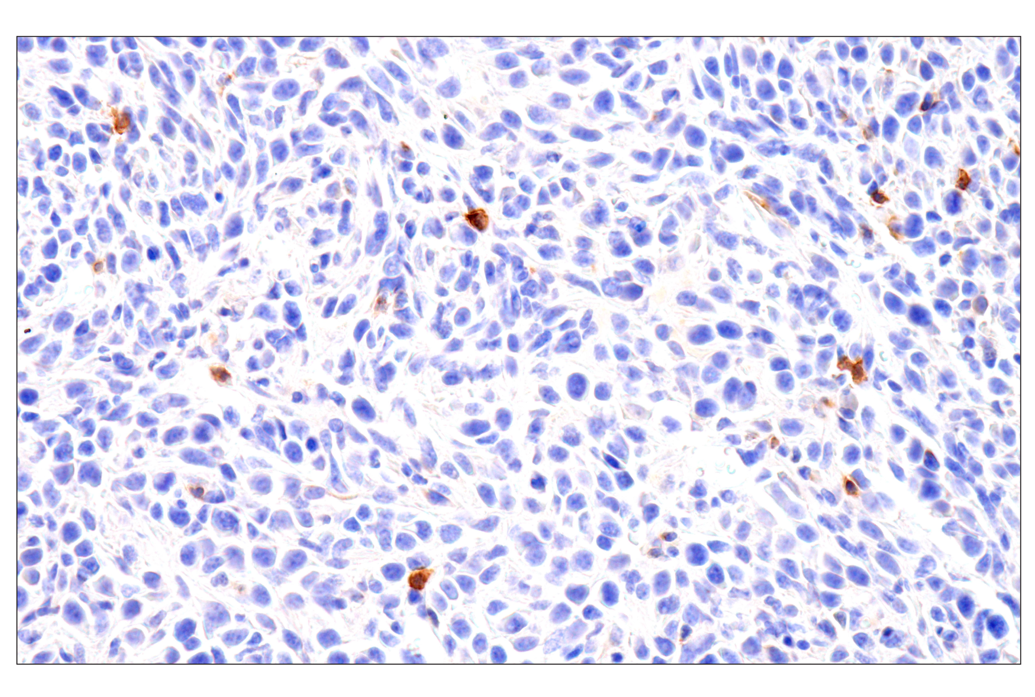 Immunohistochemistry Image 4: CD62L/L-Selectin (E7L2M) Rabbit mAb (BSA and Azide Free)