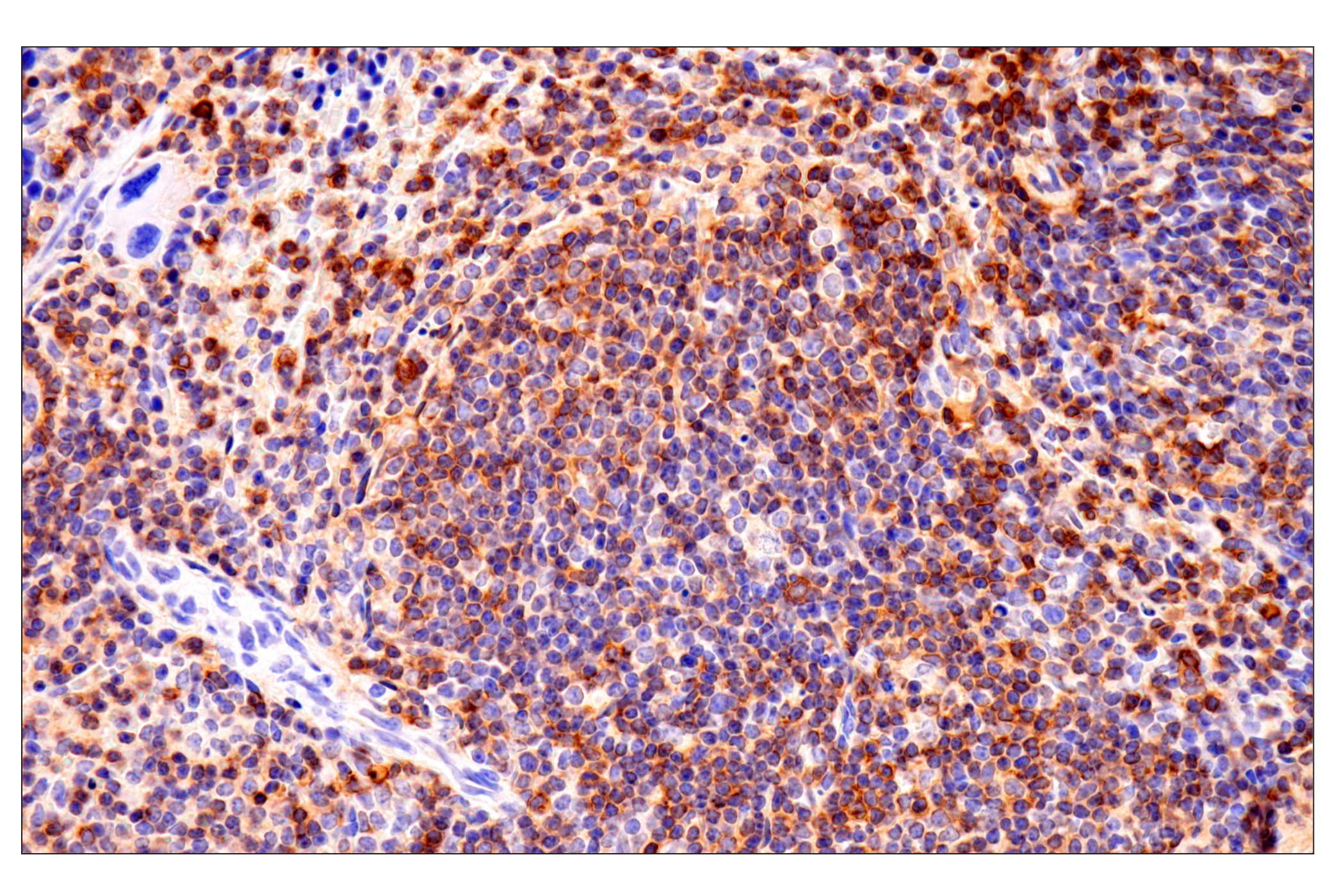 Immunohistochemistry Image 5: CD62L/L-Selectin (E7L2M) Rabbit mAb (BSA and Azide Free)