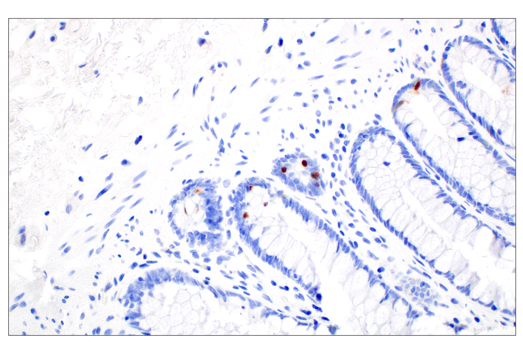Immunohistochemistry Image 2: OCA-T1 (E4T1K) Rabbit mAb (BSA and Azide Free)