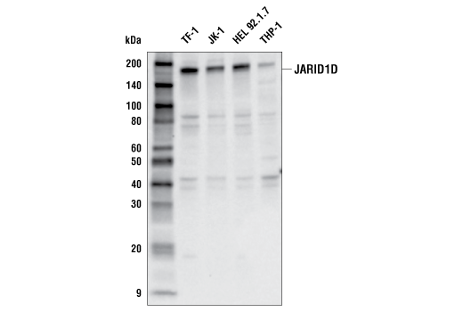  Image 6: JARID1/KDM5 Histone Demethylase Antibody Sampler Kit