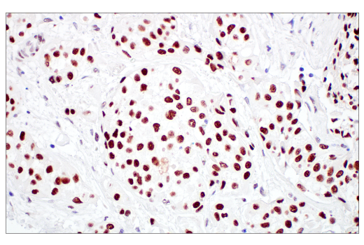 Immunohistochemistry Image 1: TIF1α/TRIM24 (E9T3N) Rabbit mAb