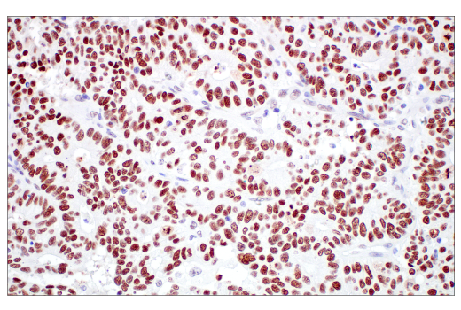Immunohistochemistry Image 2: TIF1α/TRIM24 (E9T3N) Rabbit mAb