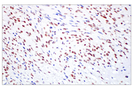 Immunohistochemistry Image 3: TIF1α/TRIM24 (E9T3N) Rabbit mAb