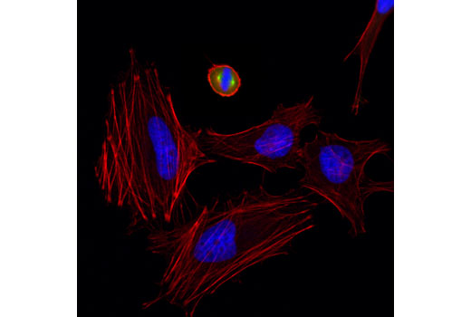 Immunofluorescence Image 1: Aurora A (D3E4Q) Rabbit mAb (BSA and Azide Free)