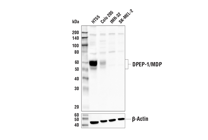 Western Blotting Image 1: DPEP-1/MDP Antibody