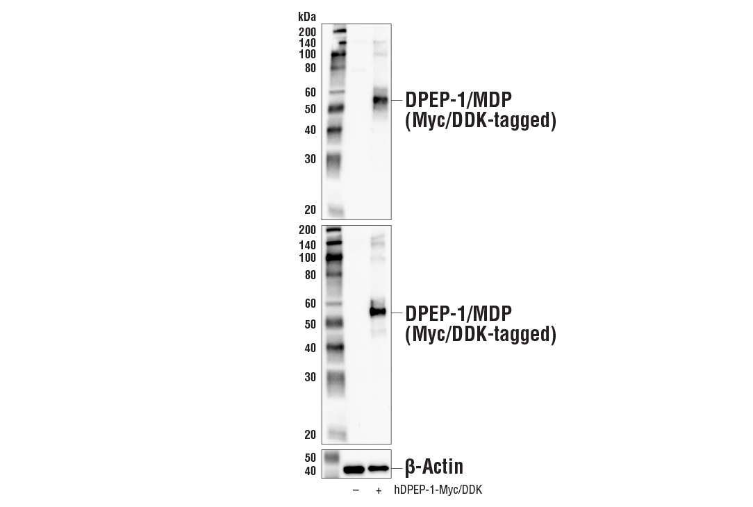 Western Blotting Image 2: DPEP-1/MDP Antibody