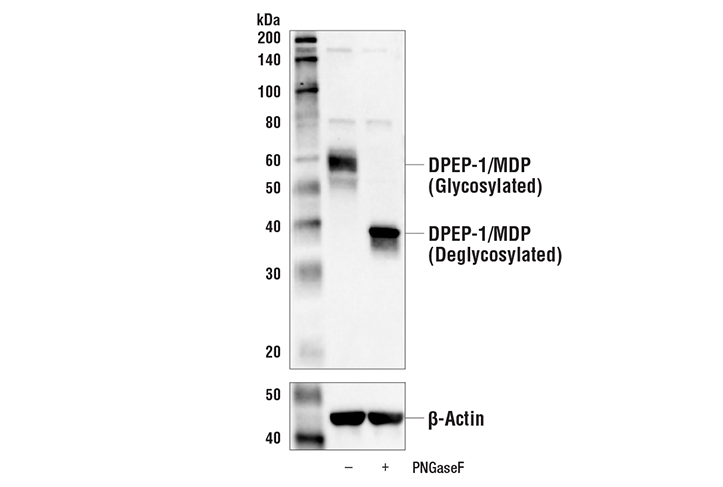 Western Blotting Image 3: DPEP-1/MDP Antibody
