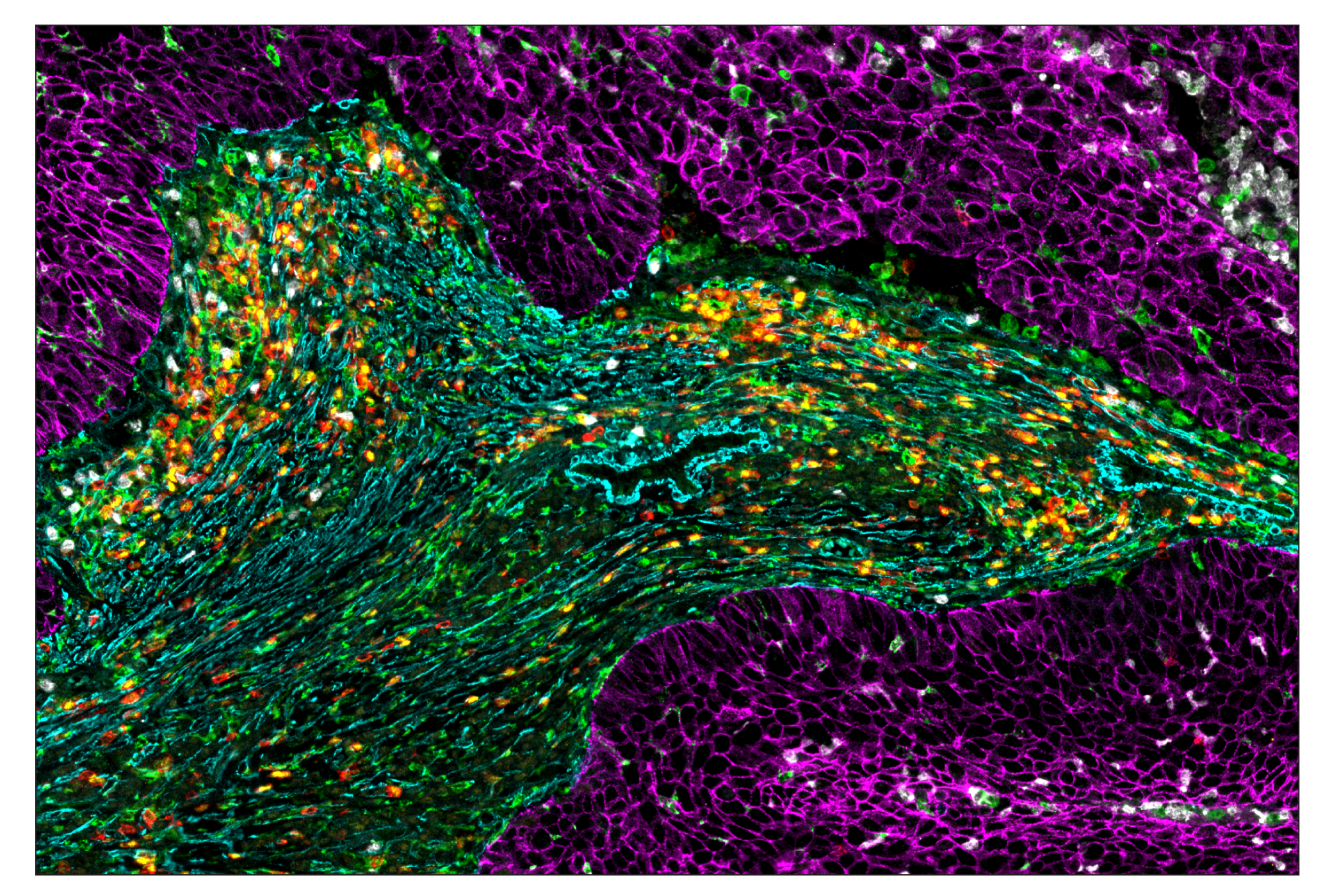 Immunohistochemistry Image 7: MHC Class II (LGII-612.14) & CO-0105-647 SignalStar™ Oligo-Antibody Pair