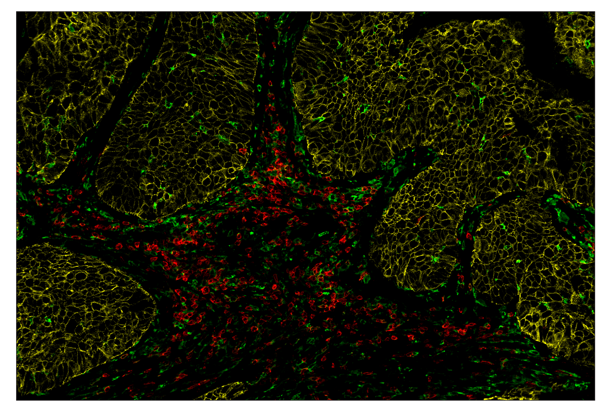 Immunohistochemistry Image 8: MHC Class II (LGII-612.14) & CO-0105-647 SignalStar™ Oligo-Antibody Pair