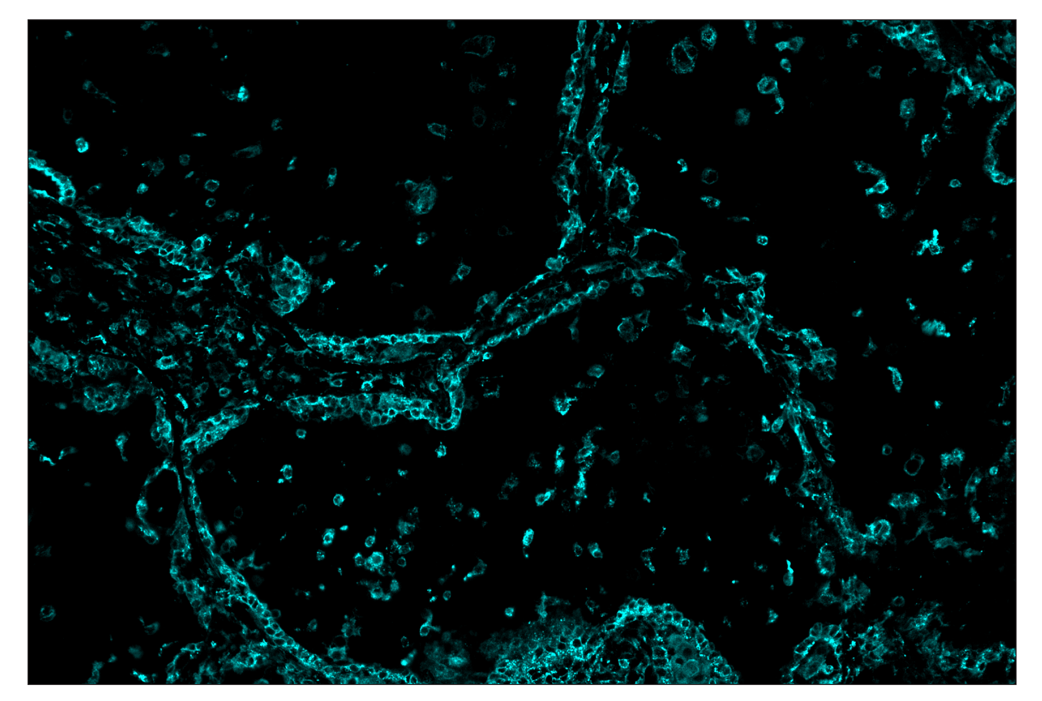 Immunohistochemistry Image 5: MHC Class II (LGII-612.14) & CO-0105-647 SignalStar™ Oligo-Antibody Pair