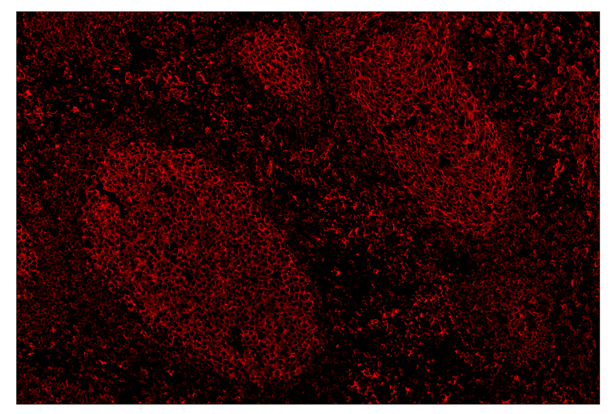 Immunohistochemistry Image 4: MHC Class II (LGII-612.14) & CO-0105-647 SignalStar™ Oligo-Antibody Pair